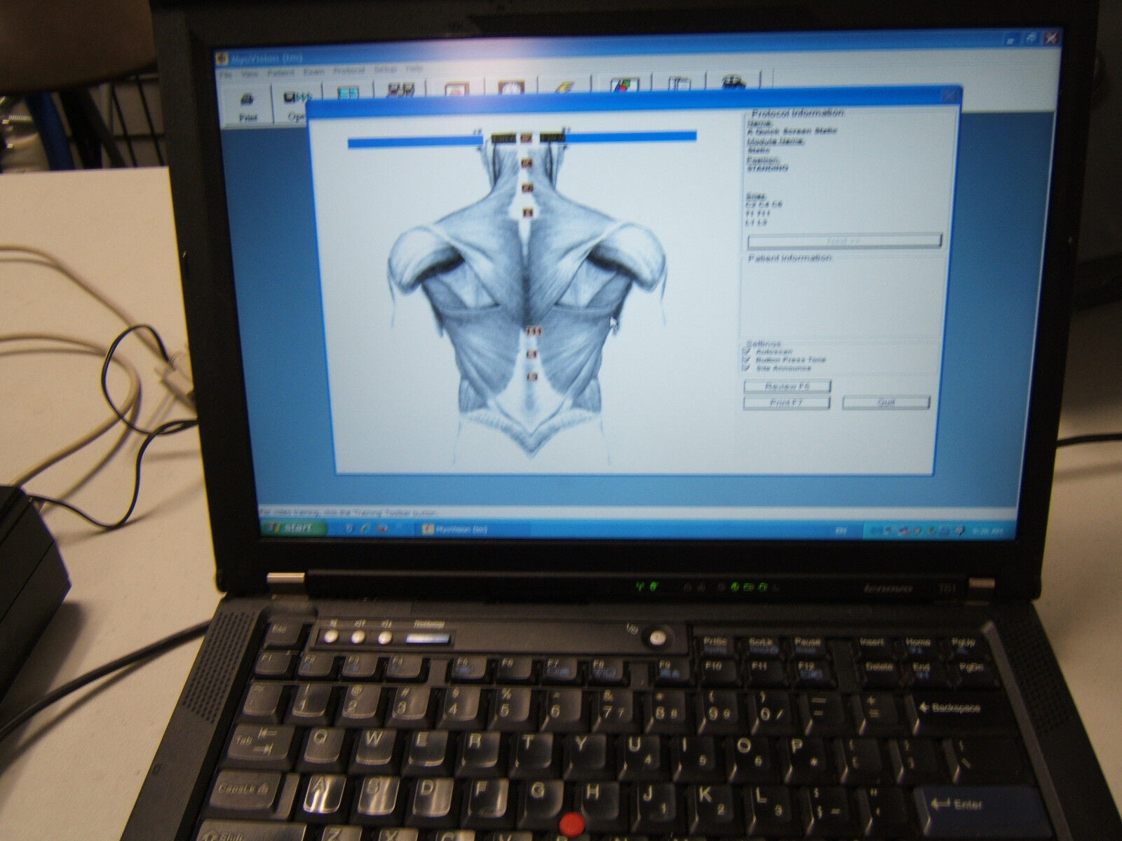 Laptop w/Validated Myovision 8000 Software Installed, Ready to Use Chiropractor